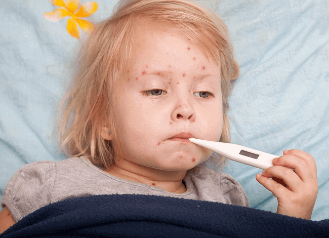 Dấu hiệu sốt xuất huyết ở trẻ giai đoạn nguy hiểm
