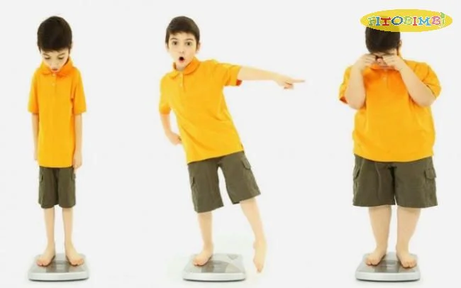 Trẻ chậm phát triển thể chất