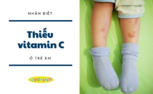 thiếu vitamin c ở trẻ em