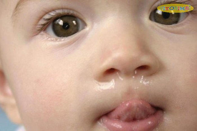 Triệu chứng viêm mũi dị ứng ảnh hưởng tới cuộc sống sinh hoạt của trẻ