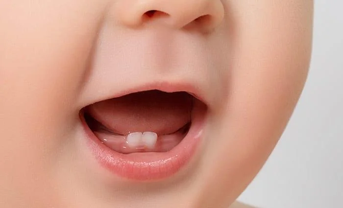 Trẻ thường bắt đầu mọc răng lúc 6 tháng tuổi