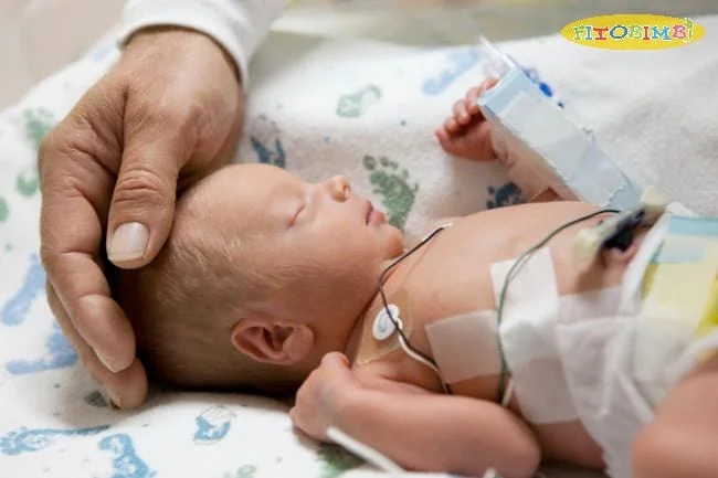 Trẻ sinh non chậm phát triển: Thử thách con phải đối mặt là gì