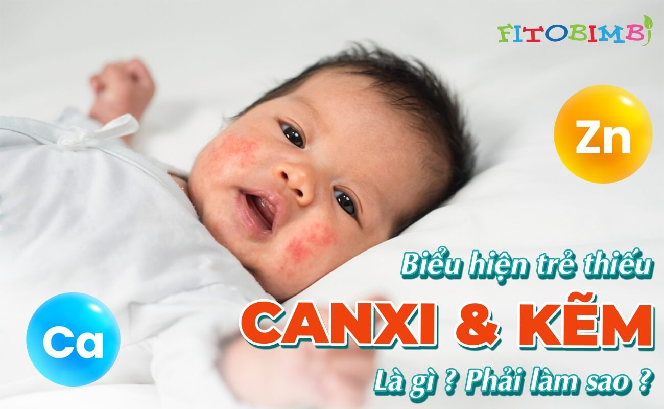 trẻ thiếu kẽm và canxi