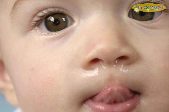 Nguyên nhân trẻ sơ sinh bị sổ mũi
