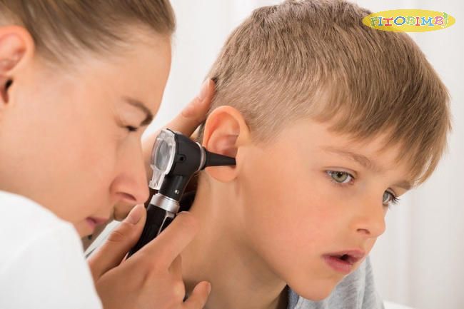 Những thông tin cần thiết về bệnh viêm tai giữa ở trẻ