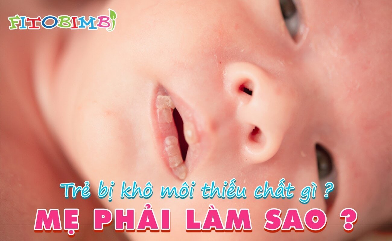 Trẻ bị khô môi thiếu chất gì
