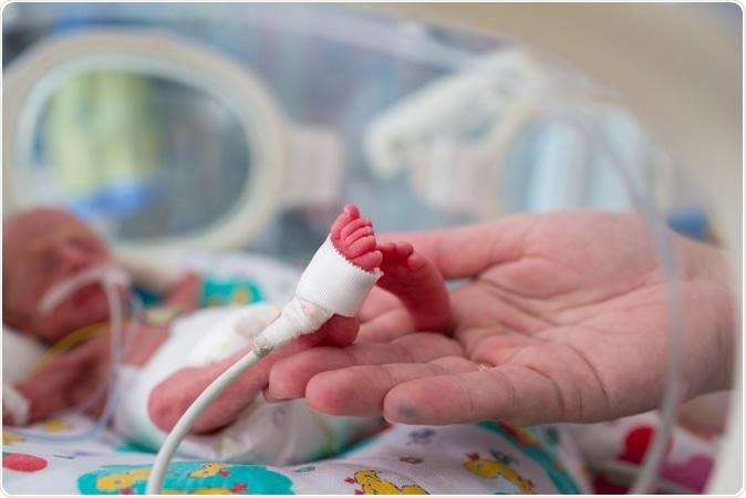 Trẻ đẻ non và cân nặng lúc sinh thấp có nguy cơ cao thiếu hụt canxi