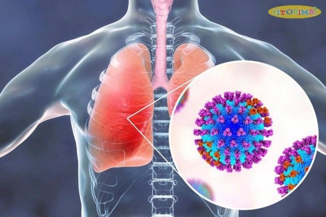 Nguyên nhân trẻ bị viêm phổi do vi khuẩn