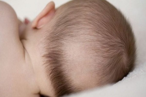 Trẻ sơ sinh sẽ bị rụng tóc khi thiếu kẽm
