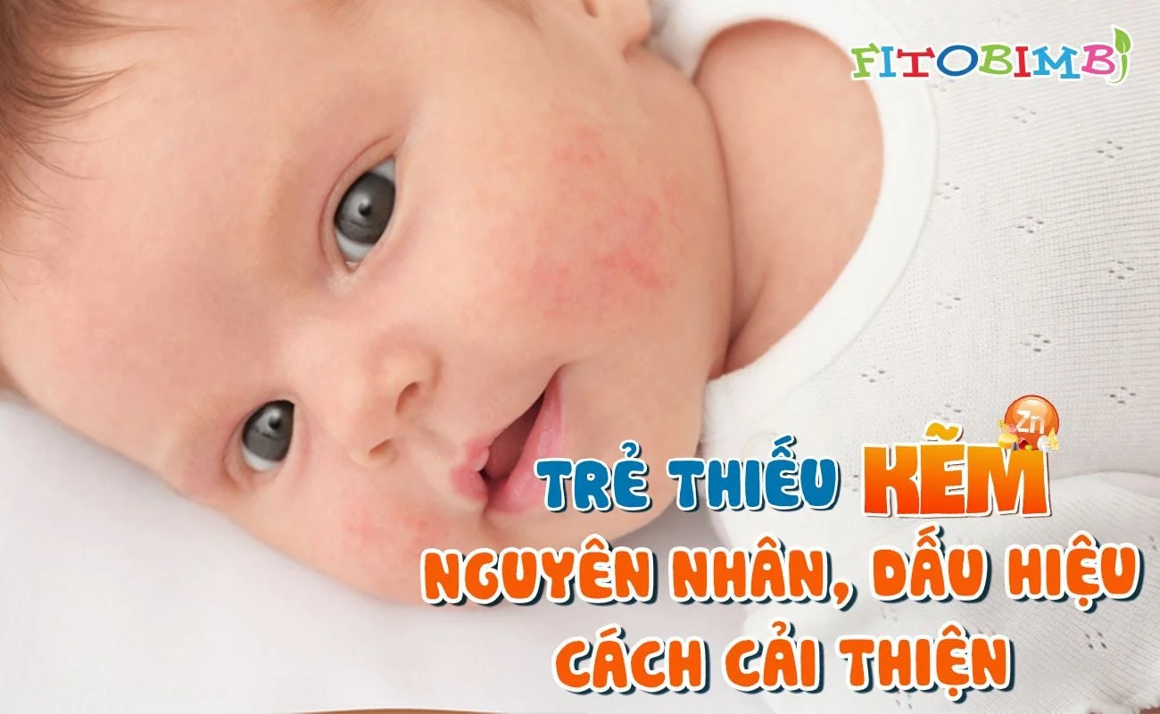 trẻ thiếu kẽm