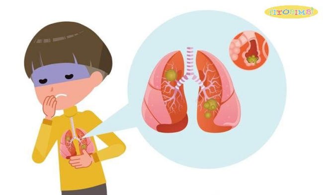 Viêm phổi ở trẻ em: Những thông tin mà CHA MẸ NÊN BIẾT