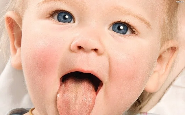 Lưỡi cũng là bộ phận ẩn chứa dấu hiệu thiếu sắt