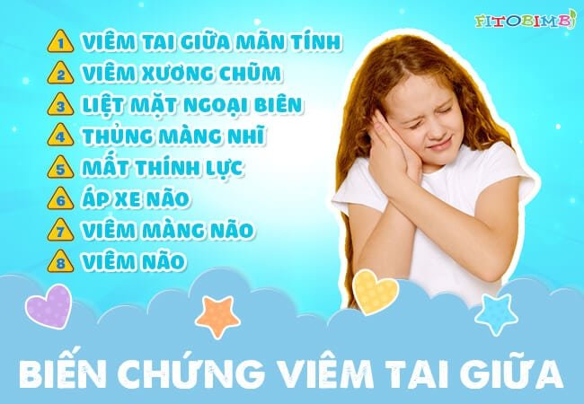 bien chung viem tai giua