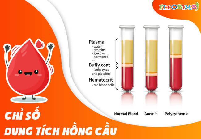 Chỉ số HCT giúp chẩn đoán tình trạng thiếu máu hiệu quả