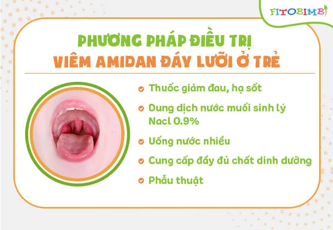 Phương pháp điều trị viêm amidan đáy lưỡi