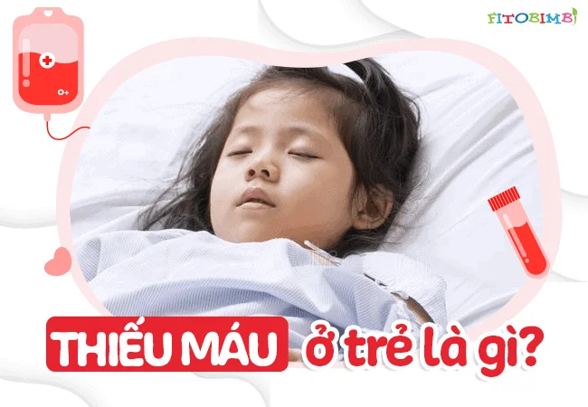 Thiếu máu ở trẻ em hiện nay chiếm tỉ lệ rất cao