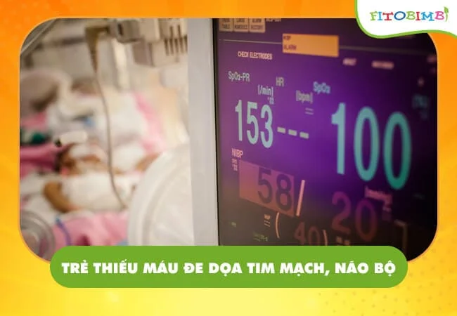 Trẻ thiếu máu có thể nguy hiểm đến tính mạng 