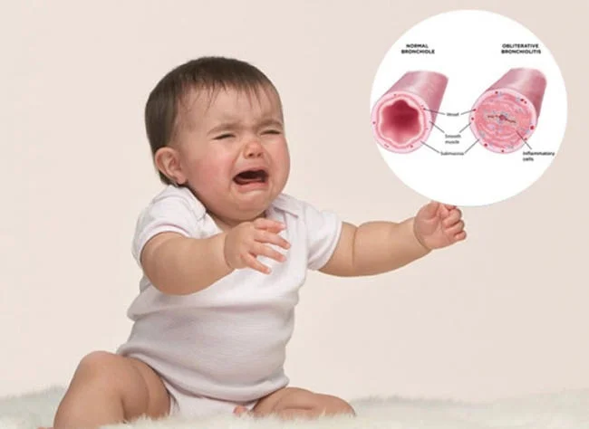 Trẻ bị viêm phế quản có nguy hiểm không? Cảnh giác với 5 biến chứng này!