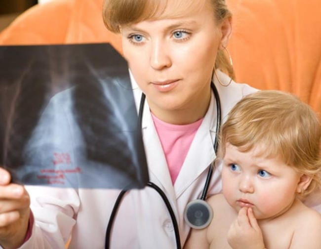 Có những biện pháp phòng ngừa viêm phế quản phổi ở trẻ em?
