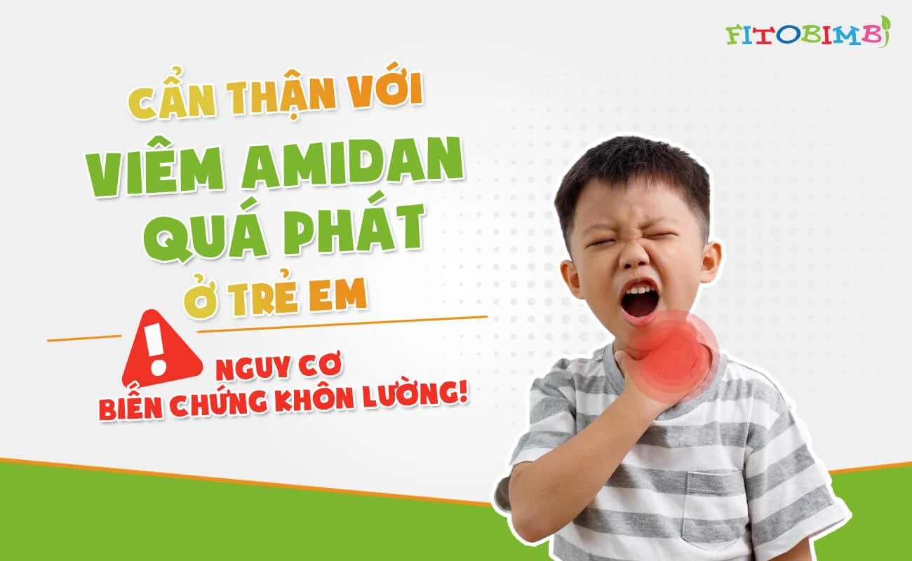 Cẩn thận với viêm amidan quá phát ở trẻ em - Fitobimbi