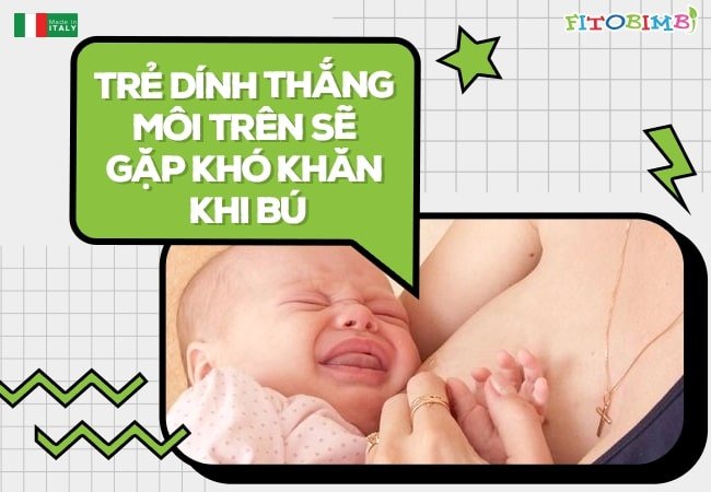 Bé sơ sinh sẽ gặp khó khăn khi bú mẹ nếu bị dị tật này
