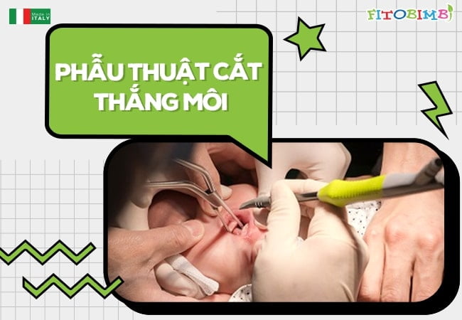 Bác sĩ có thể cắt thắng lưỡi bằng laser hoặc dao
