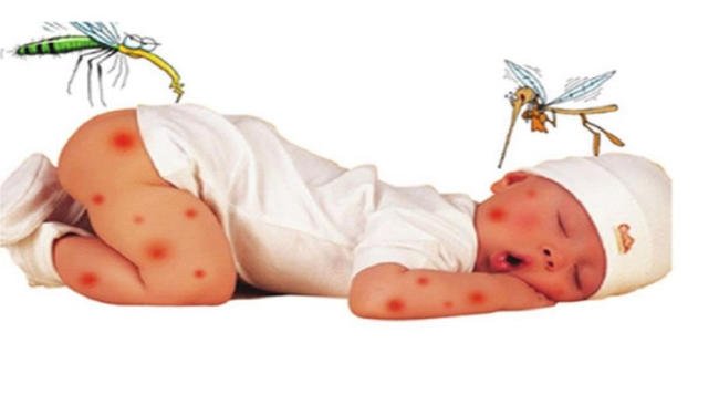Hình ảnh sốt xuất huyết ở trẻ em giai đoạn khởi phát