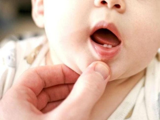 Trẻ sơ sinh mọc răng có thể gây sốt