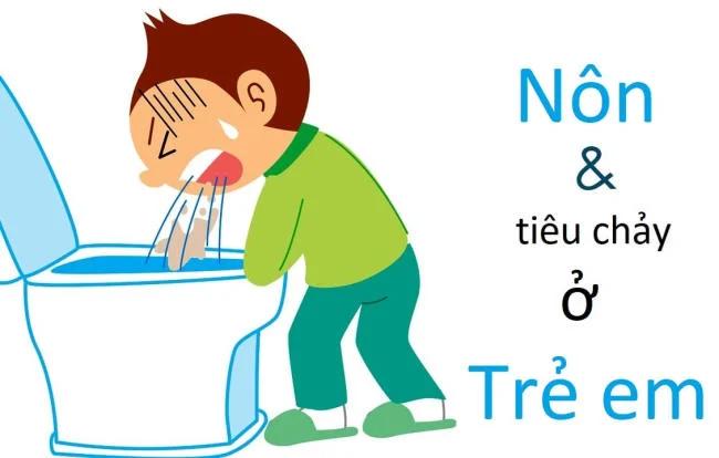 Trẻ sốt, nôn kèm tiêu chảy có liên quan đến bệnh lý đường ruột