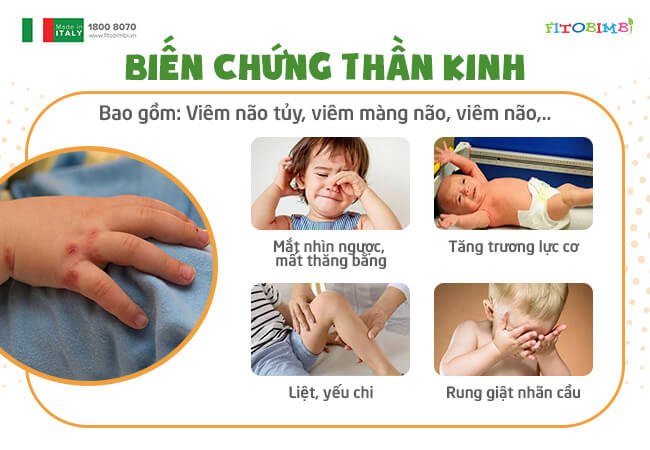 Biến chứng thần kinh