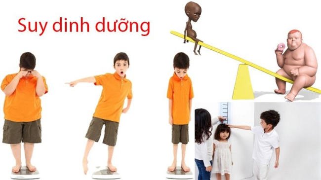 Suy dinh dưỡng là thực trạng đáng báo động ở trẻ tại Việt Nam