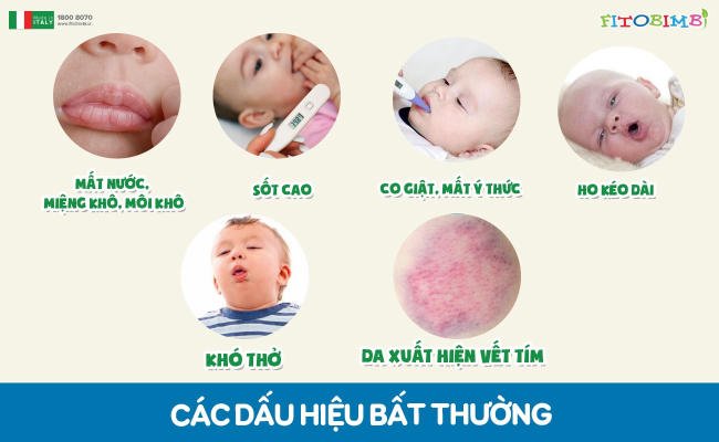 Trẻ bị ọc sữa kèm theo những dấu hiệu bất thường thì cha mẹ cần hết sức lưu tâm