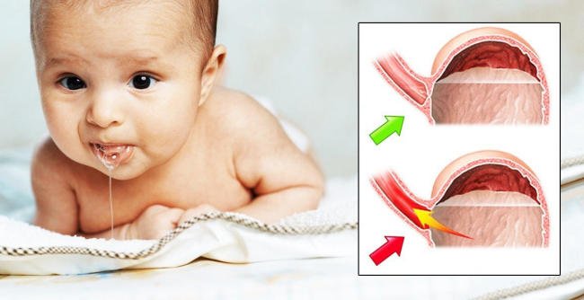 Dạ dày của trẻ sơ sinh cấu tạo thế nào