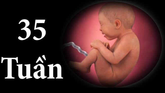 Hình ảnh thai nhi lúc 35 tuần