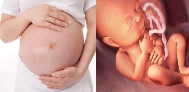 Mốc siêu âm 32 tuần cũng rất quan trọng