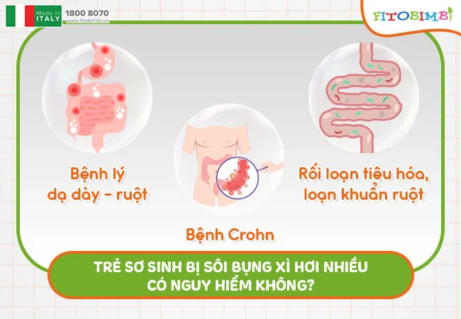 Đa phần trẻ bị sôi bụng, xì hơi đều là bình thường