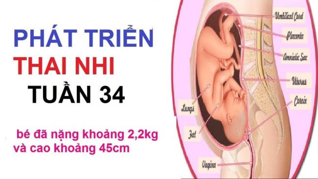 Thai nhi 34 tuần nặng trung bình khoảng 2.2kg