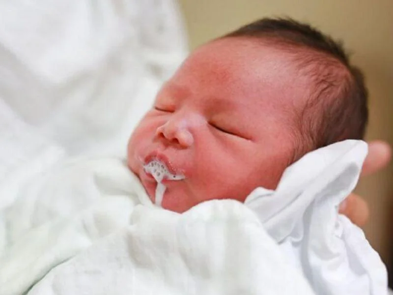 Trẻ sơ sinh bị nôn trớ có thể do nguyên nhân sinh lý hoặc bệnh lý