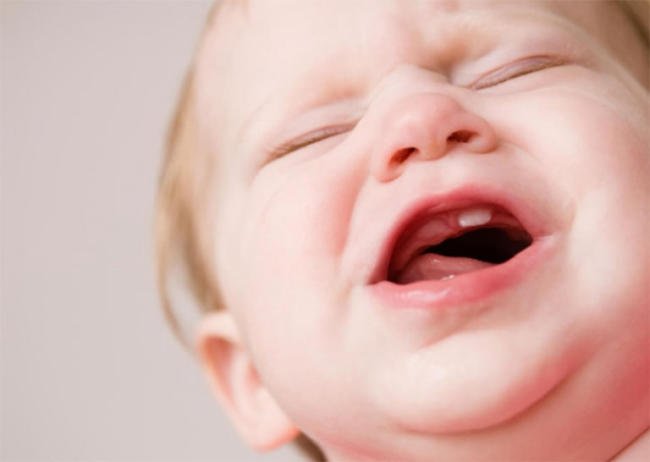 Mọc răng cũng là lý do khiến trẻ 1 tuổi hay khóc đêm