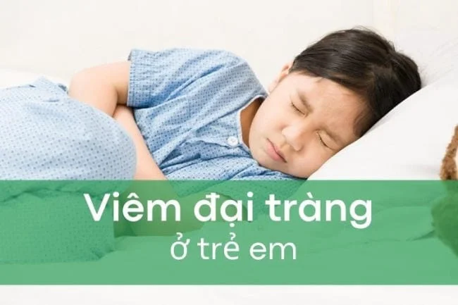 Viêm đại tràng - biến chứng rối loạn tiêu hóa nguy hiểm ở trẻ