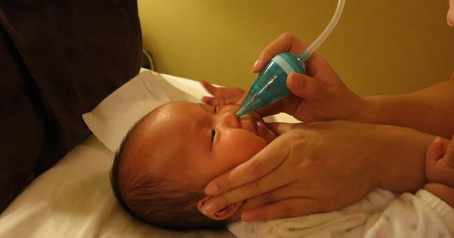 Cách hút mũi cho trẻ sơ sinh bằng dụng cụ chữ U
