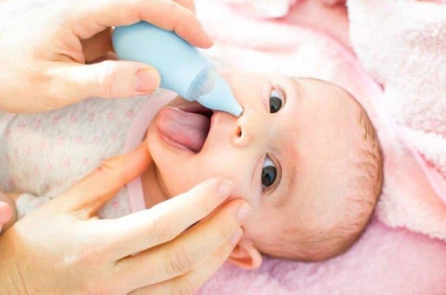 Cách hút mũi cho trẻ sơ sinh