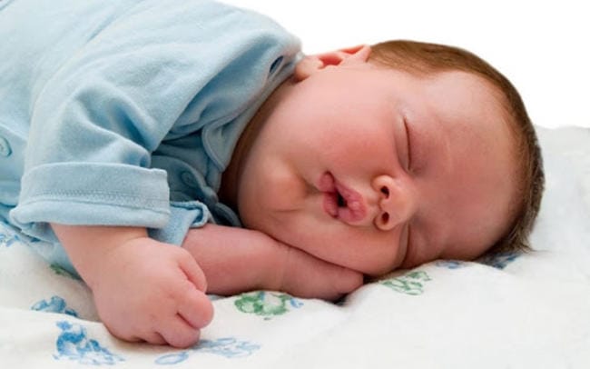 Mềm sụn thanh quản khiến trẻ ngủ ngáy
