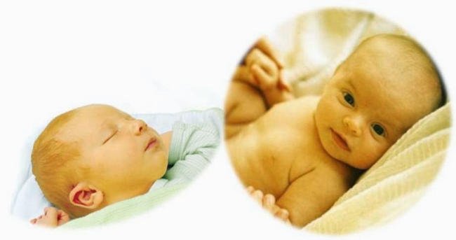 Vàng da là tình trạng thường gặp ở trẻ sơ sinh