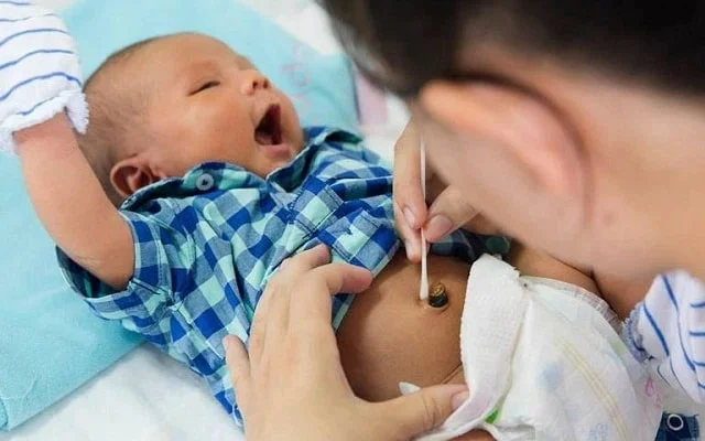 Vệ sinh sai cách khiến trẻ bị nhiễm trùng rốn