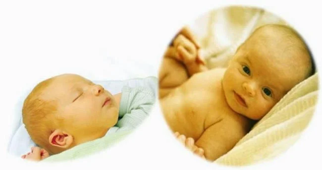 Bệnh vàng da ở trẻ sơ sinh