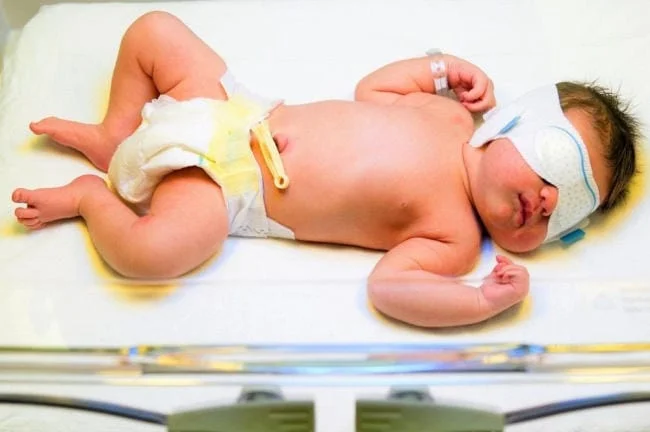 Chiếu đèn có thể khiến da của bé mẩn đỏ