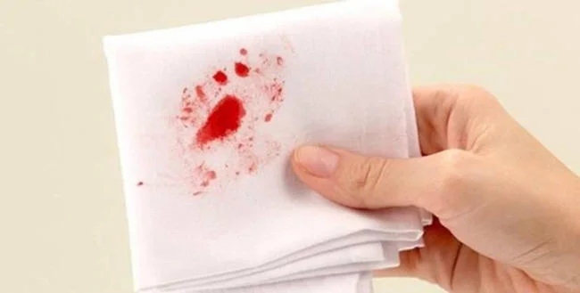Đi ngoài ra máu là hiện tượng phân có màu đỏ tươi
