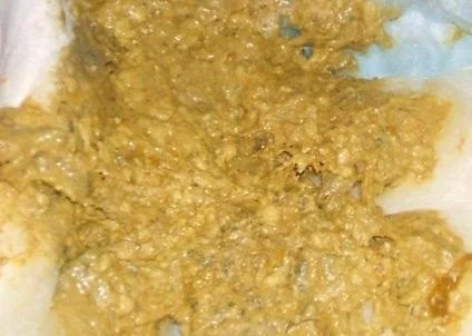 Phân kèm thức ăn chưa kịp tiêu hóa của bé