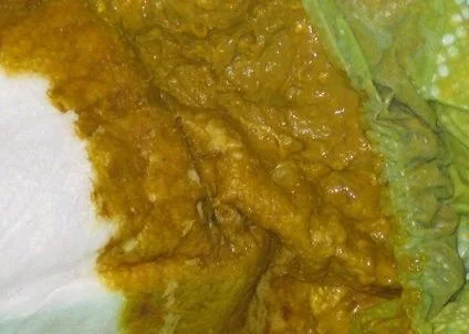 Phân sống của trẻ sơ sinh có màu sẫm, lợn cợn hạt